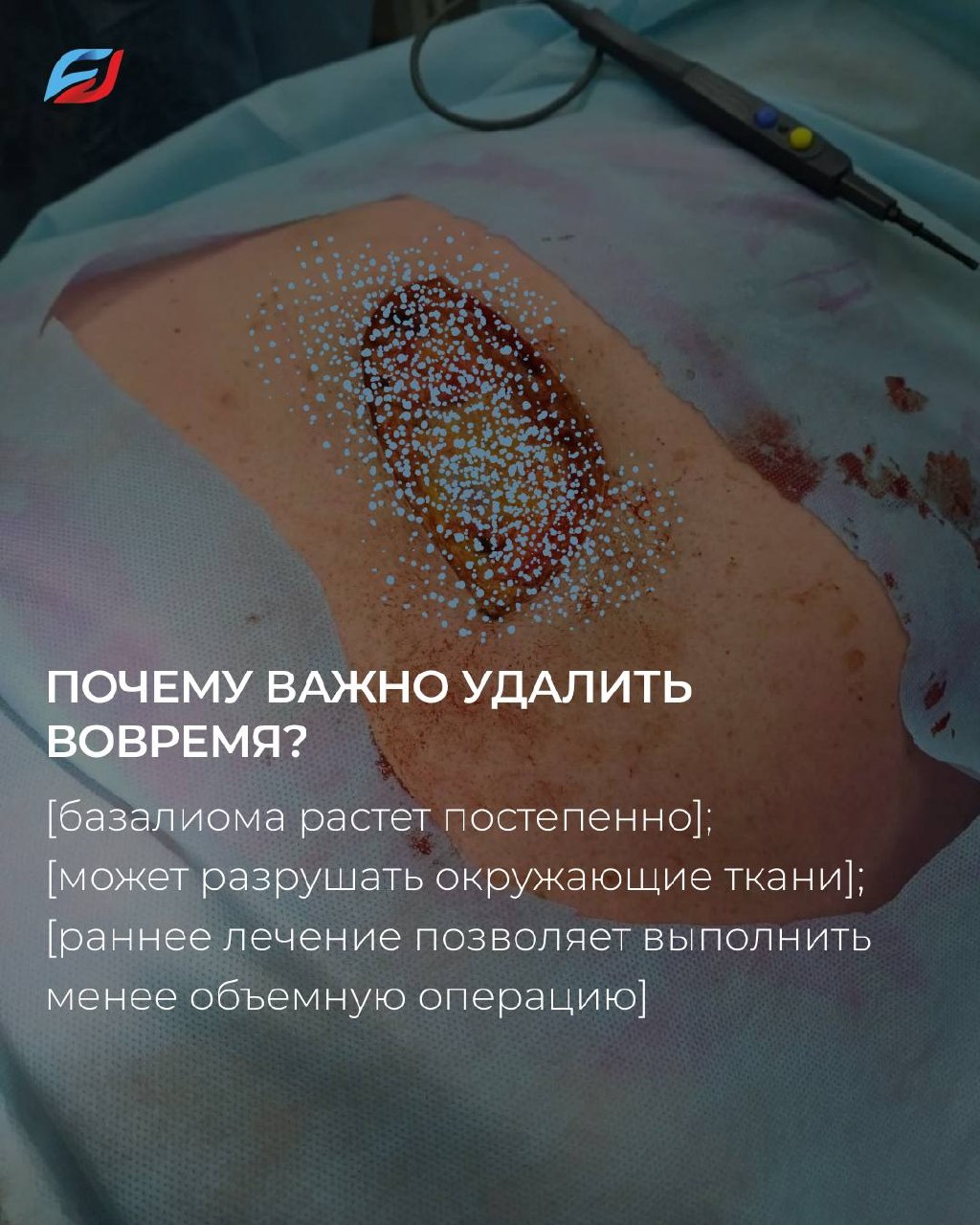 Кожа нередко подает сигналы раньше, чем появляются какие-либо симптомы.