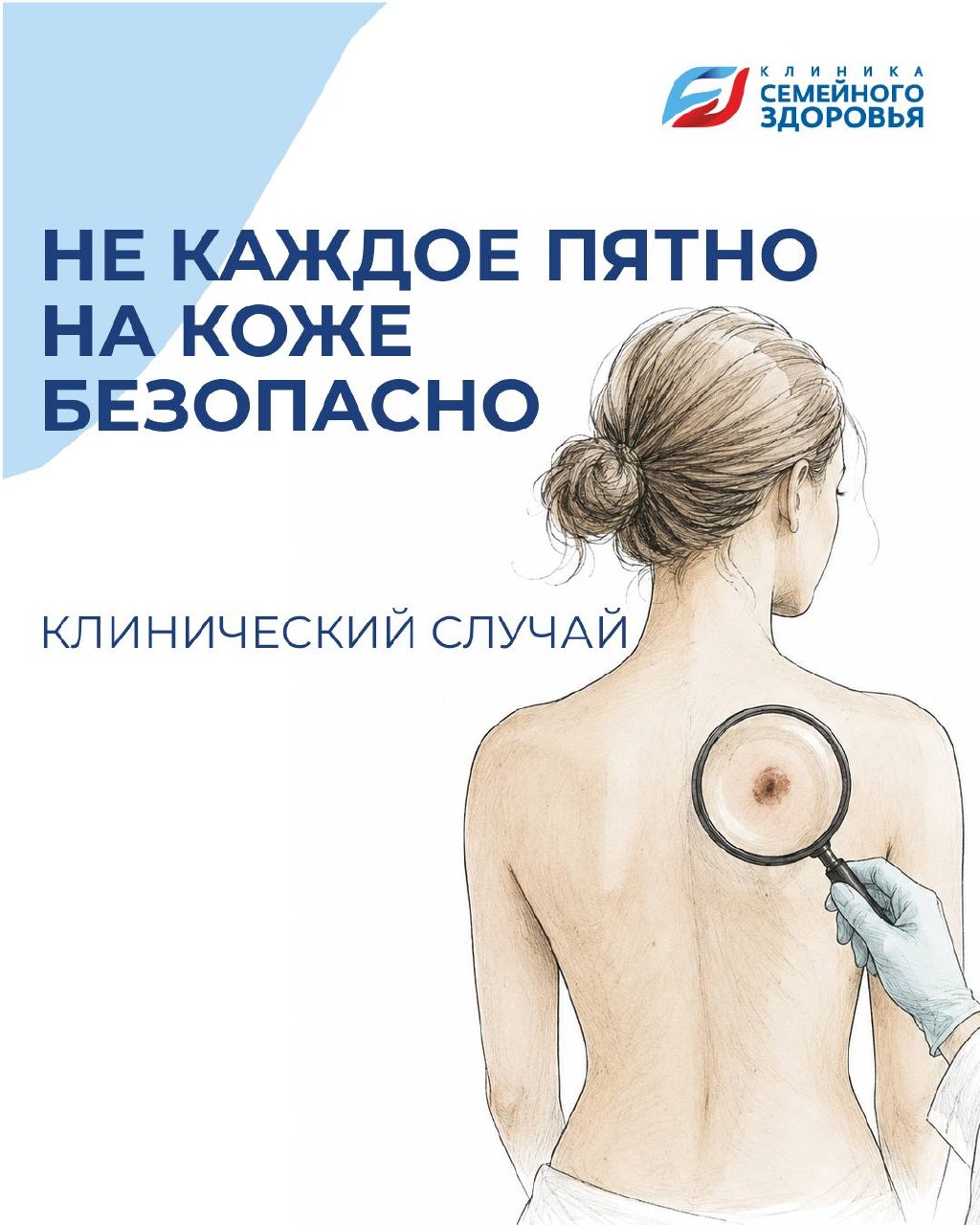 Кожа нередко подает сигналы раньше, чем появляются какие-либо симптомы.