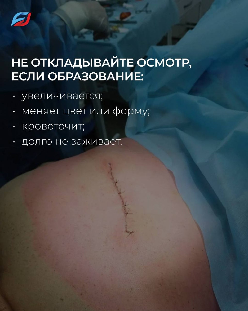 Кожа нередко подает сигналы раньше, чем появляются какие-либо симптомы.